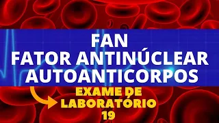 EXAMES DO FAN - FATOR ANTINÚCLEAR - AUTOANTICORPOS