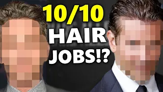 TOP 5 Undetectable Hair Transplants Of Celebrities!