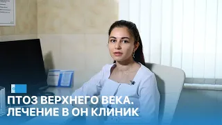 Птоз верхнего века. Лечение в ОН КЛИНИК.