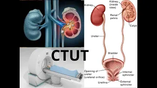 فحص الأشعة المقطعية على المسالك البولية بالتفصيل CT UT