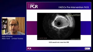 Latest insights: when to choose orbital atherectomy - EuroPCR 2021