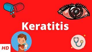 Keratitis, Causes, Signs and Symptoms, Diagnosis and Treatment.