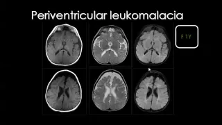 Imaging of Pediatric CVS   Prof Dr  Mamdouh Mahfouz In Arabic