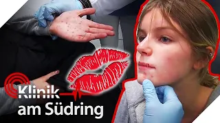 Beim Knutschen angesteckt?! 💋  Hannah (14) hat vielleicht Herpes 🙈 | Klinik am Südring | SAT.1