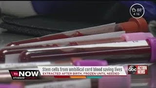 Stem cells from umbilical cord blood saving lives