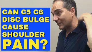 Can C5 C6 Disc Bulge Cause Shoulder Pain? | Dr. Walter Salubro Chiropractor In Vaughan