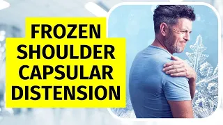 Try This Frozen Shoulder Treatment for FAST Pain Relief