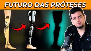 Quanto as próteses evoluiram em 10 anos? Pedro Pimenta.