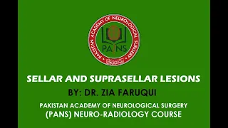 Sellar and Suprasellar Lesions by Dr. Zia Faruqui - PANS