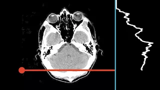 X-ray CT sweep