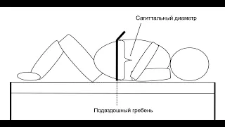 Чому жир на животі-загроза вашому здоров'ю