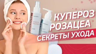 КУПЕРОЗ и РОЗАЦЕА особенности ухода за чувствительной кожей | Современные способы коррекции