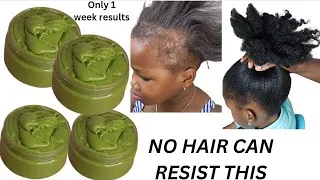 VISIBLE RESULTS IN DAYS MOST POTENT HERBAL HAIR GROWTH MASK 😱 USE DAILY FOR  EXTREMELY HAIR GROWTH