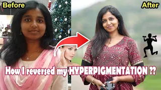 How I reversed my HYPERPIGMENTATION ? | #drsharmika #hyperpigmentation #skincare #cure