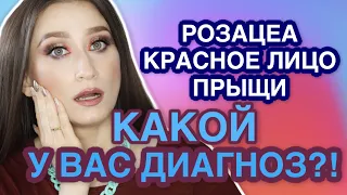 РОЗАЦЕА, АКНЕ, ДЕМОДЕКОЗ, ДЕРМАТИТ: ищем отличия❗️