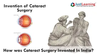 All You Need To Know About Cataract | Cataract In India | Just Learning