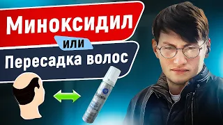 ПЕРЕСАДКА ВОЛОС или МИНОКСИДИЛ ? | Что лучше выбрать?