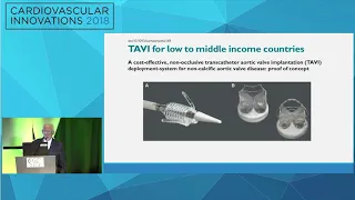 CVI2018 Session: New aortic innovations you don't know about - Michael J. Mack, MD