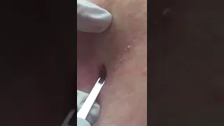 You’re a Crusty Guy! DPOW Extraction #shorts