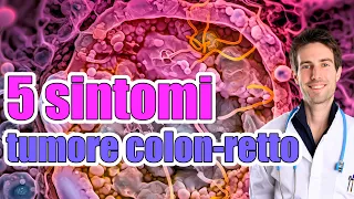 5 segnali di tumore del COLON-RETTO⚠️ I sintomi da riconoscere per prevenire i tumori dell'intestino