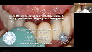 Smile Design: Integrating prosthetic, surgical & biologic parameters using digital & analog tools