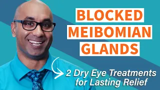 Blocked Tear Ducts | 2 dry eye treatment tips for lasting relief!