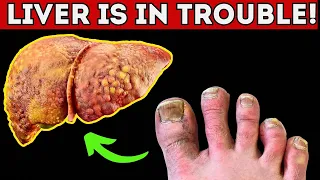 6 Signs Your Feet Are Telling You That Your Liver Is In Trouble