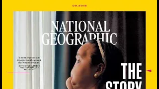 Youngest face transplant recipient shares story in National Geographic