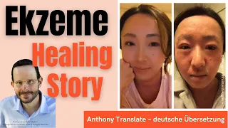 Healing Story – von Ekzemen befreit – Anthony William – deutsche Übersetzung