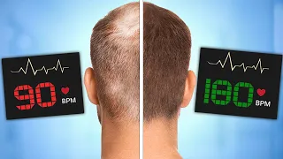 Best Exercises For Hair Loss Prevention (According to Science)