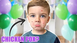 LOGAN'S Birthday VLOG *will it be a CHICKEN POX party?