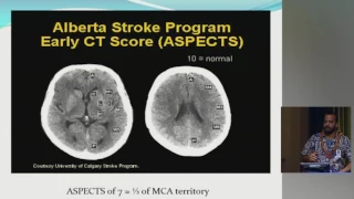 A Practical Approach to the Managment of Ischemic Stroke   Rony Salem