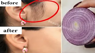 Stop shaving! Here's how to get rid permanently facial, body and pubic hair.