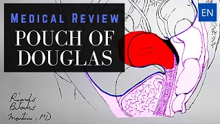 What is the Pouch of Douglas / Rectouterine Pouch? (ObGyn Pelvic Anatomy)