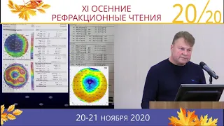 Особенности расчёта оптической силы ИОЛ у пациентов после РКТ –  Касьянов Александр Анатольевич