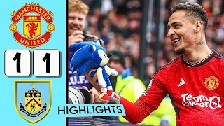 Manchester United vs Burnley 1-1 | Antony Goal, Burnley late penalty | Match Highlights