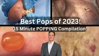 BEST Pops of 2023! (Pimples, Blackheads, Cysts, & More!) | 15 Minute Compilation!