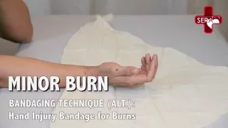 Hand Injury Bandage for Burns | Singapore Emergency Responder Academy, First Aid and CPR Training