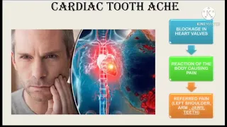 National Oral Medicine and Radiology  Day - 24-04-2021 - video series-1.Hypertension and Oral Health