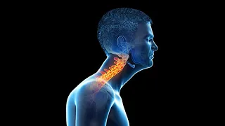 Forward head posture is a myth | Common pitfalls in cervical postural dysfunction, and its solution