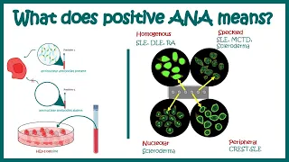 Antinuclear Antibodies (ANA) test and their patterns | ANA test | What does ANA test positive mean?