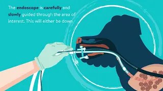 Endoscopy for Cats and Dogs - Animation