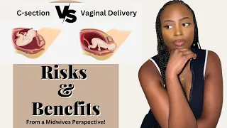 C-section vs. Vaginal birth | The Pros and Cons | Your Virtual Midwife