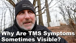 Why are TMS Symptoms Sometimes Visible?