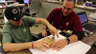 Man undergoes physical therapy after toe-thumb transplant