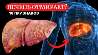 10 ПРИЗНАКОВ того что ваша ПЕЧЕНЬ ОТМИРАЕТ . Об этих проблемах вы даже не догадываетесь.