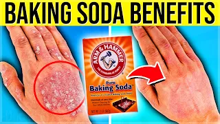 9 POWERFUL Health Benefits Of Using Baking Soda Every Day!