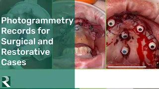 Photogrammetry Records for Surgical and Restorative Cases