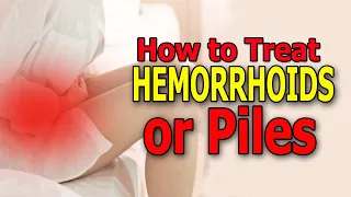 How to Treat Hemorrhoids or Piles - Hemorrhoid Treatment at Home