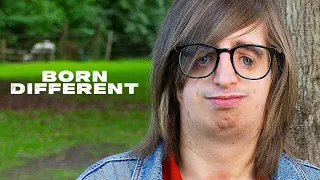 Bullied For Being Born Without Ears Or Cheekbones | BORN DIFFERENT